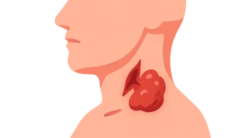 Complications in Head and Neck Surgery