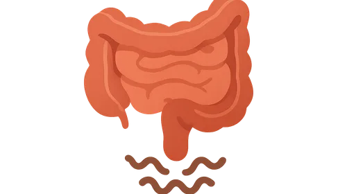 Irritable Bowel Syndrome