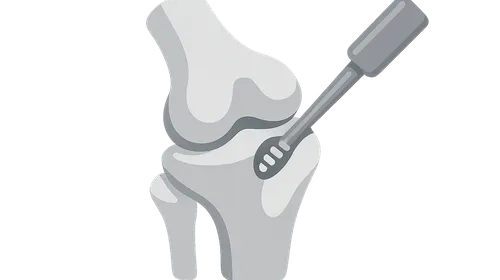 Orthopedic Surgery Basics