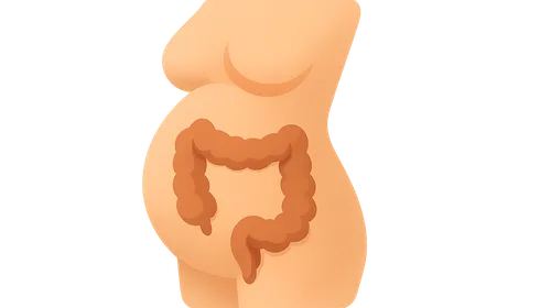 IBD in special populations