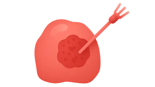 Tumor Ablation Techniques