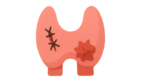 Endocrine surgery complications