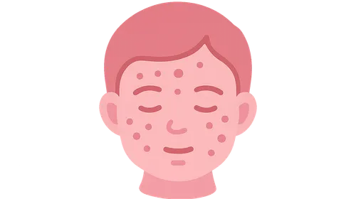 Pediatric Dermatology Basics