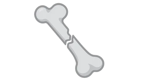 Fractures in Children