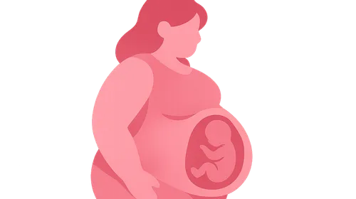 Obesity in pregnancy