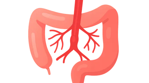 Mesenteric Vascular Disease