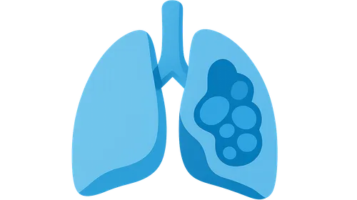 Congenital Lung Malformations