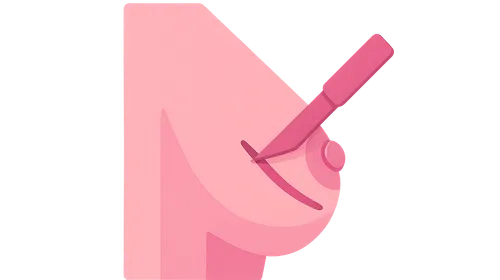 Oncoplastic Breast Surgery