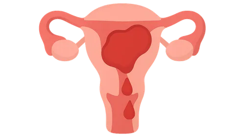 Obstetric Hemorrhage