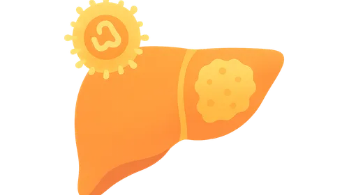 Hepatitis B and hepatocellular carcinoma