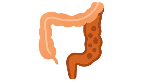 Medical management of Crohn's disease