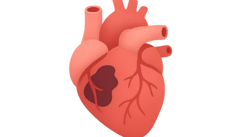 Cardiac complications