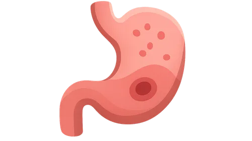 Gastritis and peptic ulcer disease