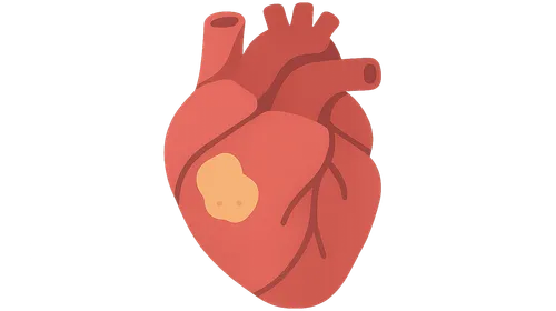 ACS pathophysiology and classification