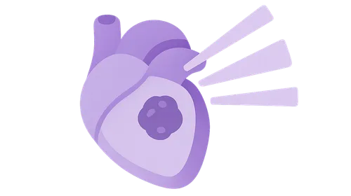 Principles of Radiation Therapy