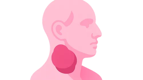 Head and neck pathology