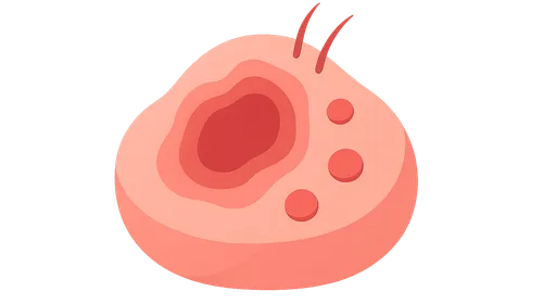 Cytomegalovirus Cutaneous Manifestations