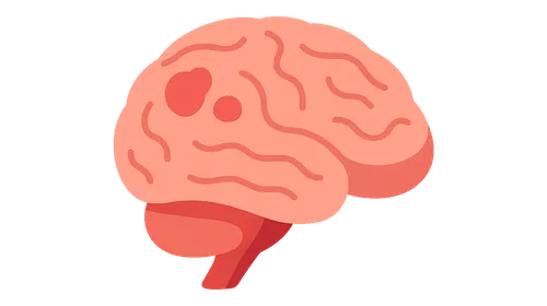 Meningitis and Encephalitis