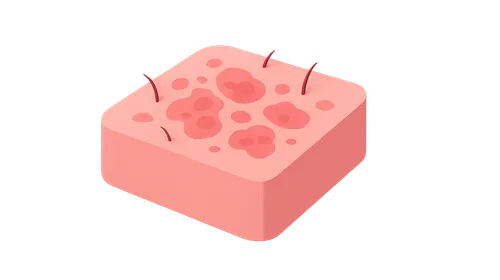 Treatment Strategies for Eczematous Disorders