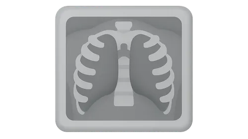 X-ray principles and interpretation