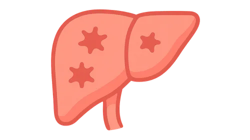 Graft-versus-host disease