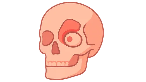 Orbital Complications of Sinusitis