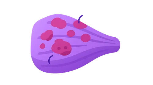 Inflammatory Myopathies