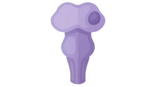 Brainstem lesions and clinical correlations