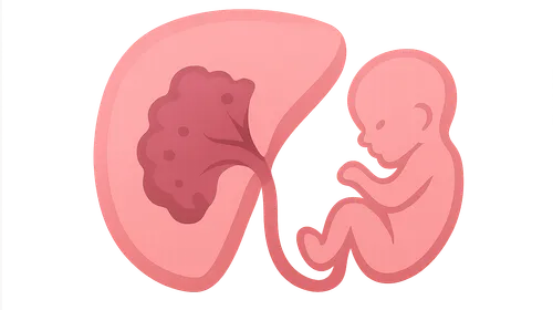 Placental Abnormalities