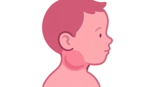 Pediatric Head and Neck Masses