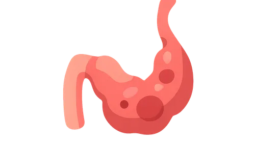 Appendiceal Pathology