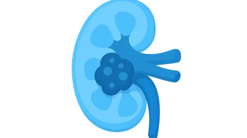 Contrast-Induced Nephropathy