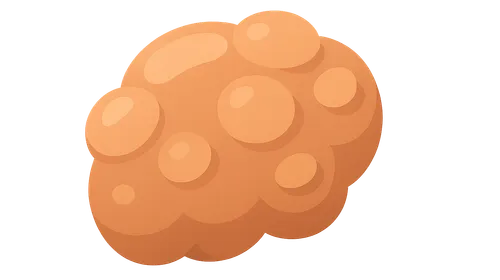 Benign Soft Tissue Tumors