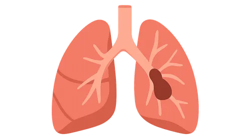Pulmonary Vascular Diseases