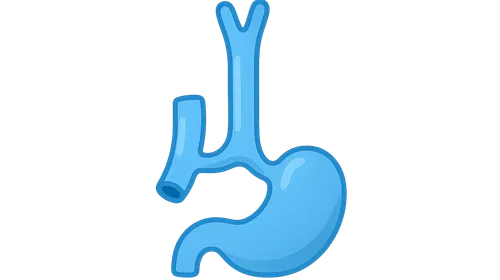 Esophageal Atresia and Tracheoesophageal Fistula