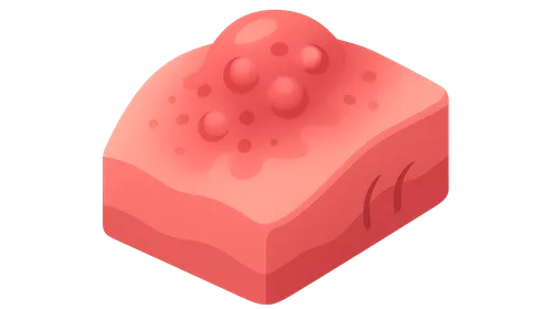 Chronic Inflammation