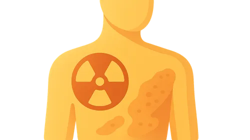 Radiation Accidents Management