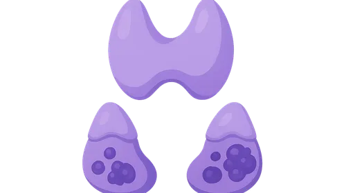 Multiple Endocrine Neoplasia