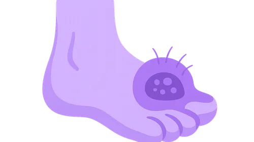 Drugs Used in Gout and Hyperuricemia