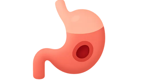 Peptic Ulcer Disease