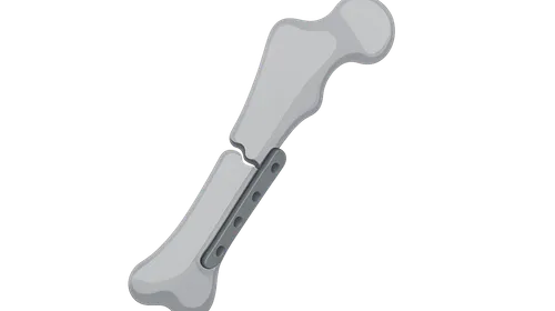 Principles of Fracture Management