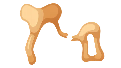 Traumatic Ossicular Disruption