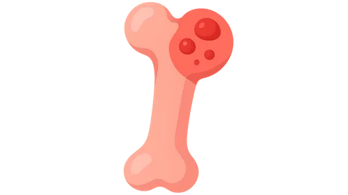 Pediatric Bone and Joint Infections