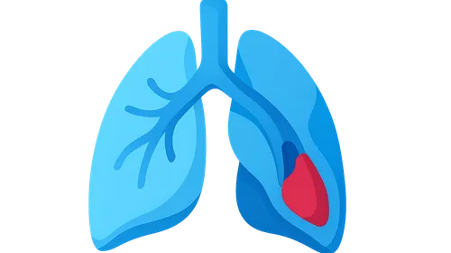 V/Q mismatch in pulmonary embolism