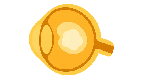 Diseases of the Lens