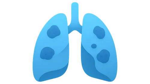 Occupational Lung Diseases