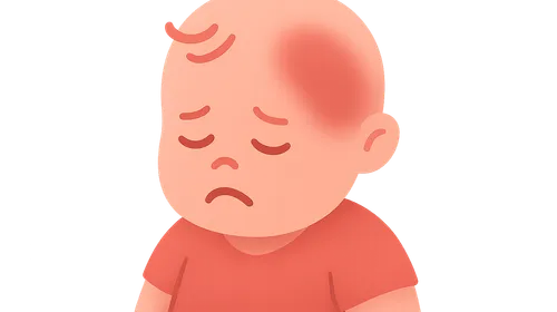 Shaken Baby Syndrome