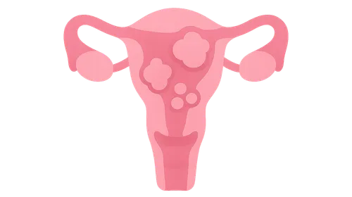 Diseases of Female Genital Tract