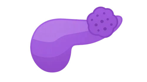 Neuroendocrine Tumors