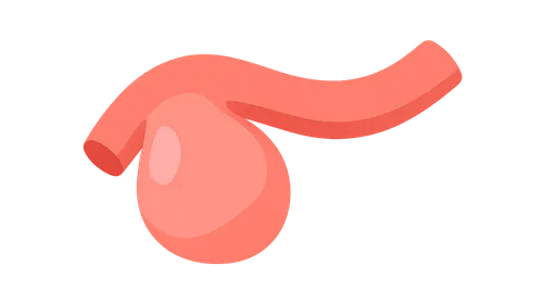 Coronary artery aneurysms